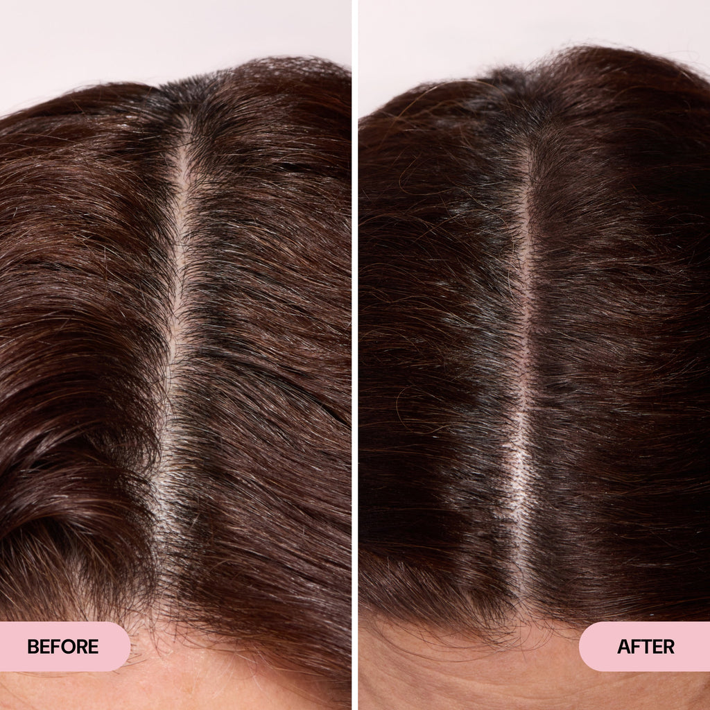 before and after
