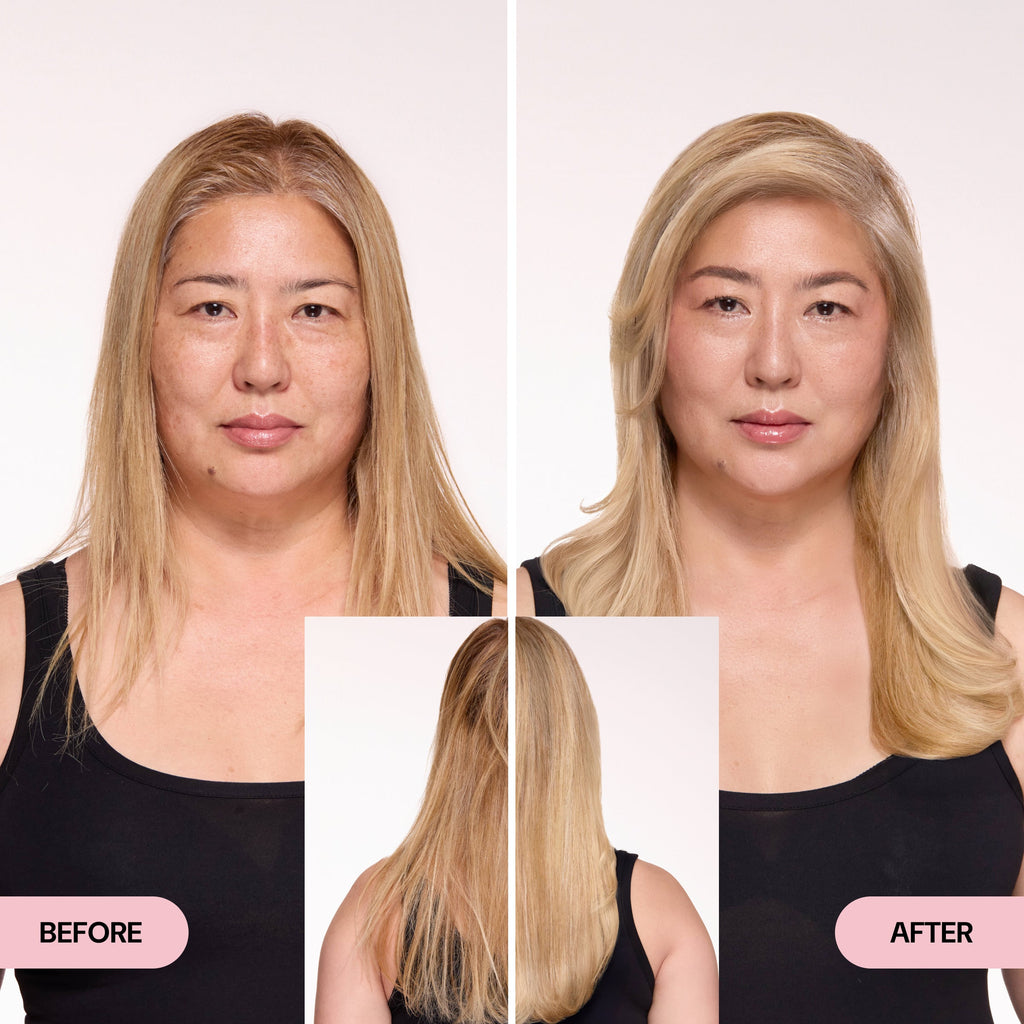 Before & After