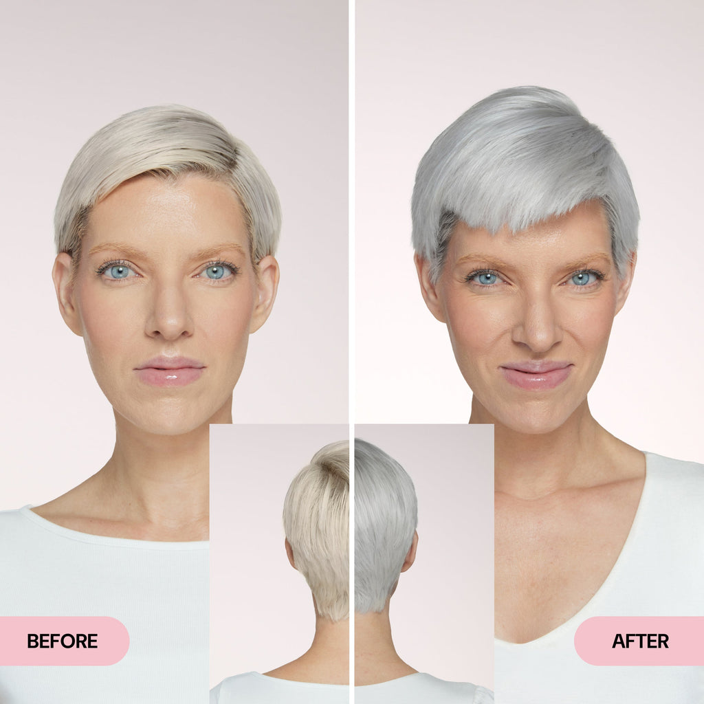 Before and After 